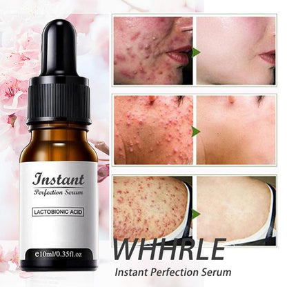 DermaYouth – Argireline Anti-Aging Formula – image 6