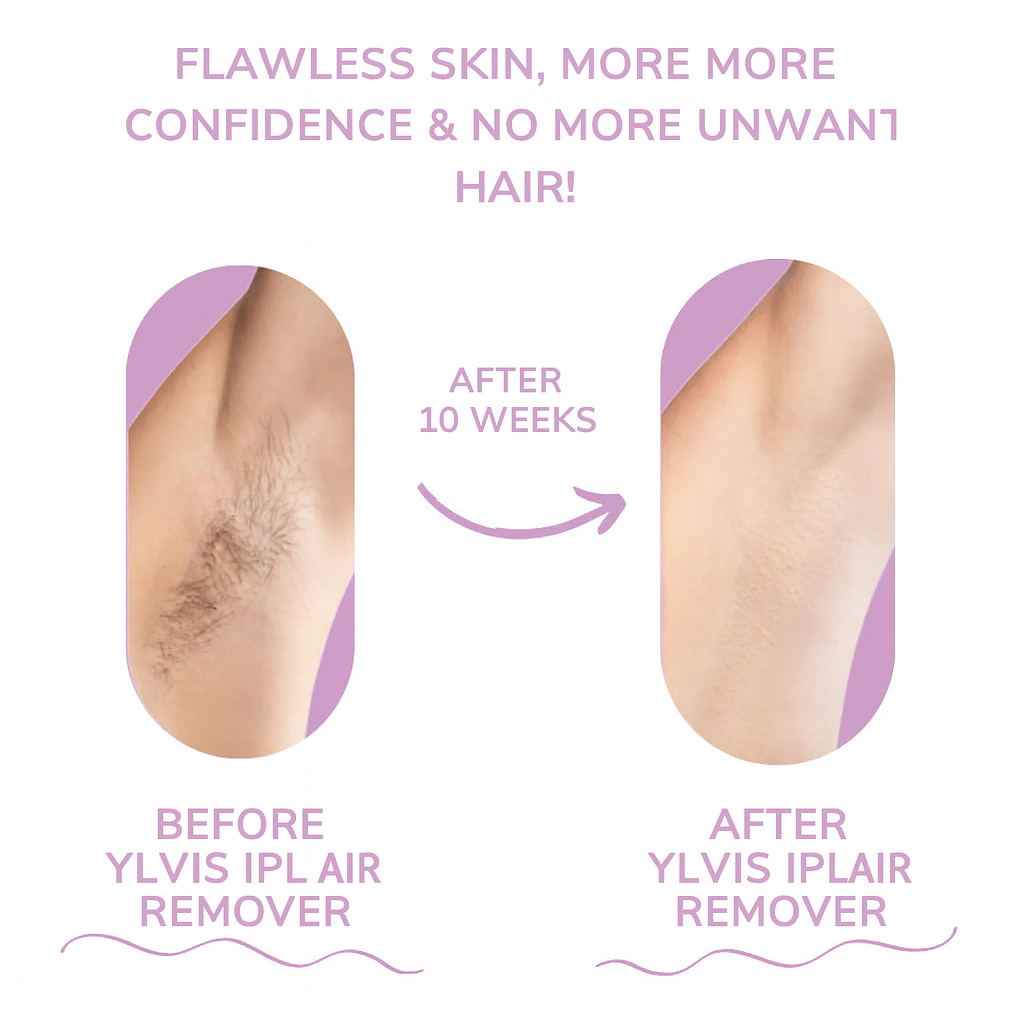 GlowEase - IPL Hair Remover for Effortless Smooth Skin – image 7