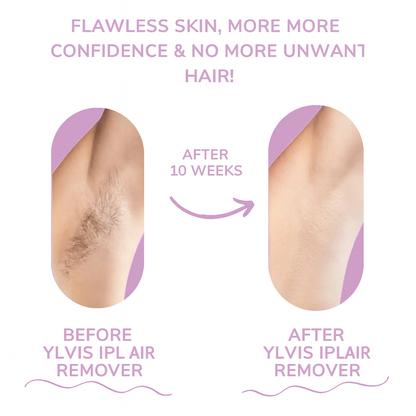 GlowEase - IPL Hair Remover for Effortless Smooth Skin – image 7