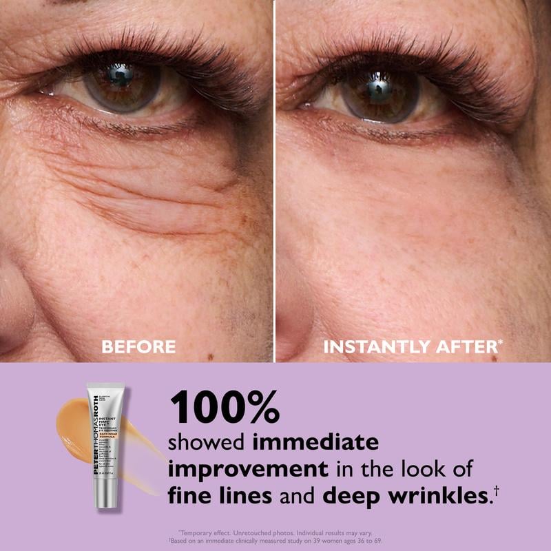 BlinkRevive – Instant Eye Tightening Solution – image 9