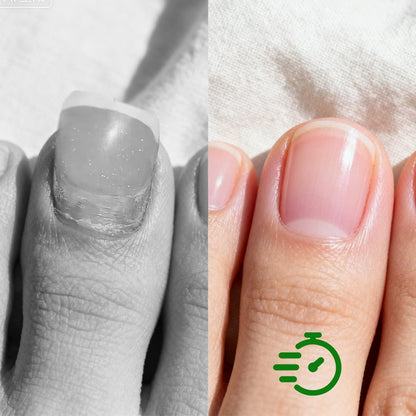 NailRevive Pro – Antifungal Repair Solution – image 6