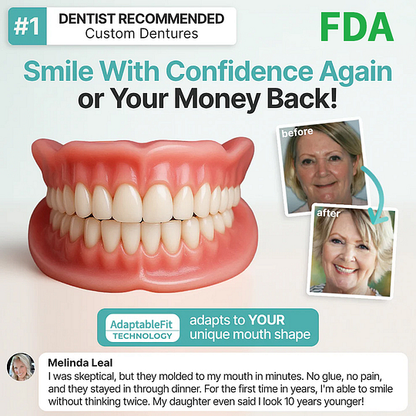 SmileLock – Premium Full Denture Solution – image 6