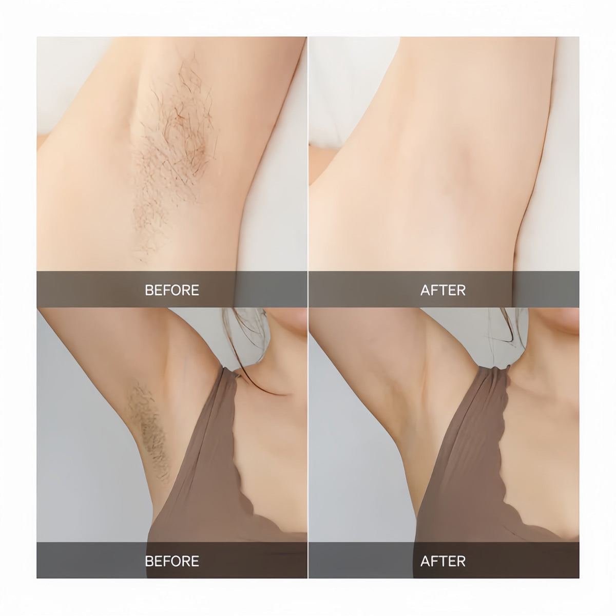 GlowBeam - Precision Hair Remover – image 9