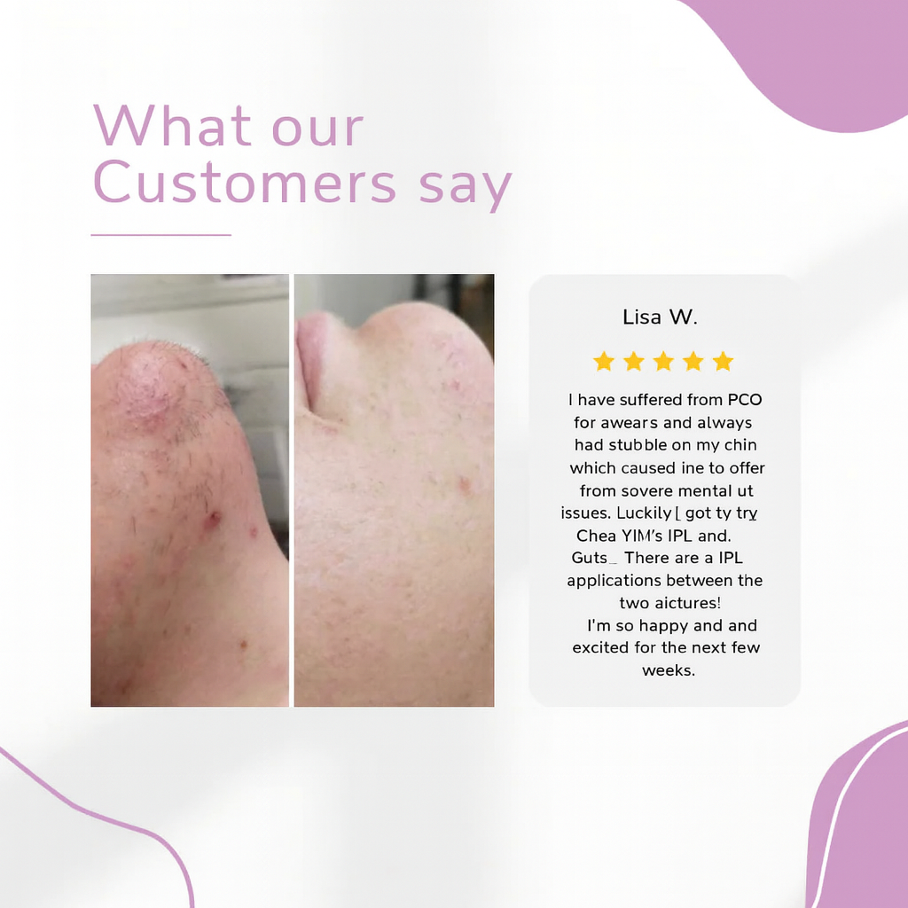 GlowEase - IPL Hair Remover for Effortless Smooth Skin – image 8