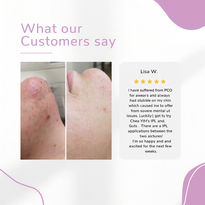 GlowEase - IPL Hair Remover for Effortless Smooth Skin – image 8