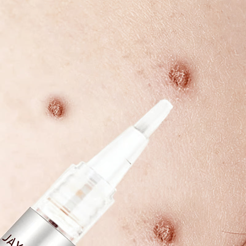 ClearGuard – Effective Wart Removal Pen – image 7