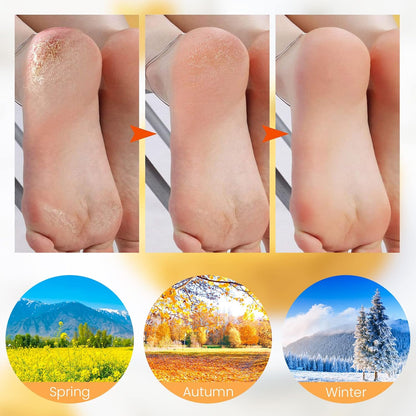 VelvetHeel Socks – Smooth Skin Foot Care – image 10