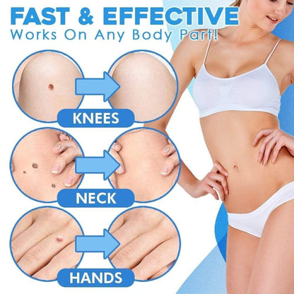 TagGone - Quick & Safe Skin Tag Remover – image 6