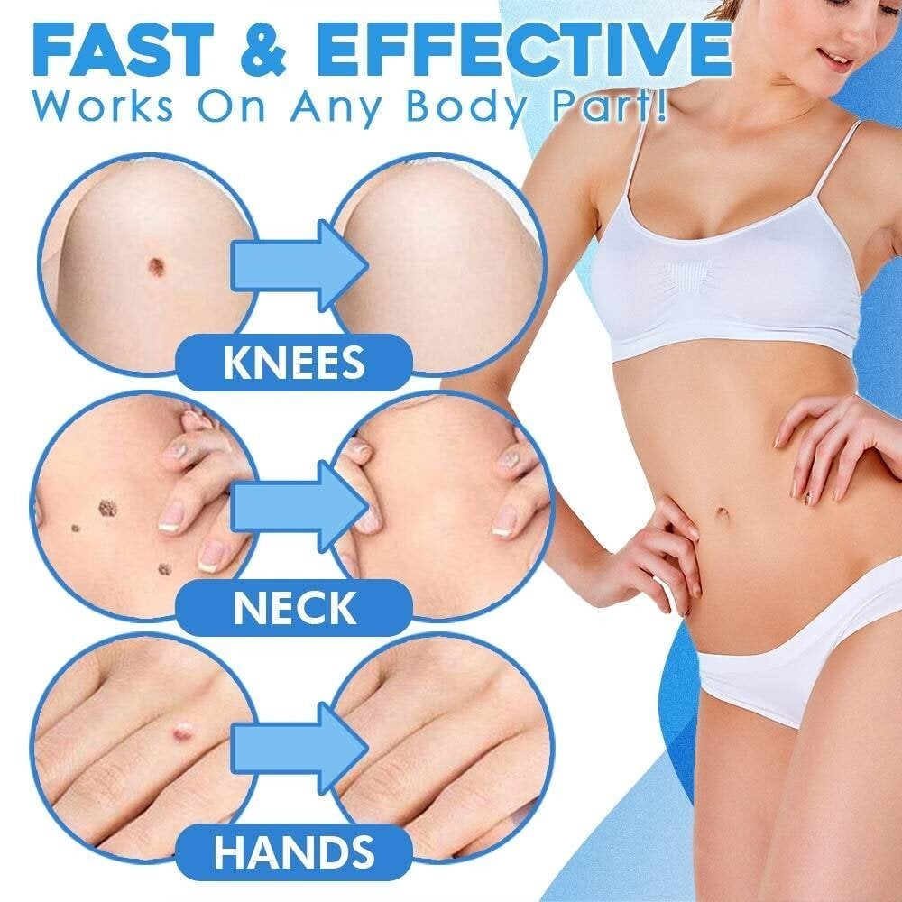 TagSnatch – Fast Auto Tag Removal Kit – image 6