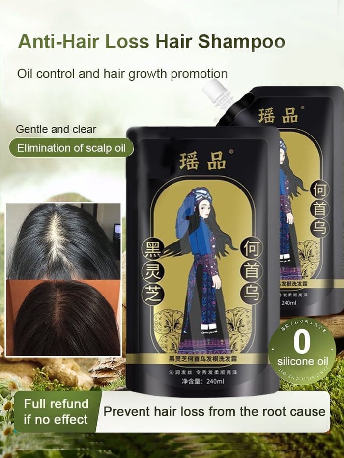 RootRevive – Ginseng Extract Root Nourishing Shampoo – BUY 1