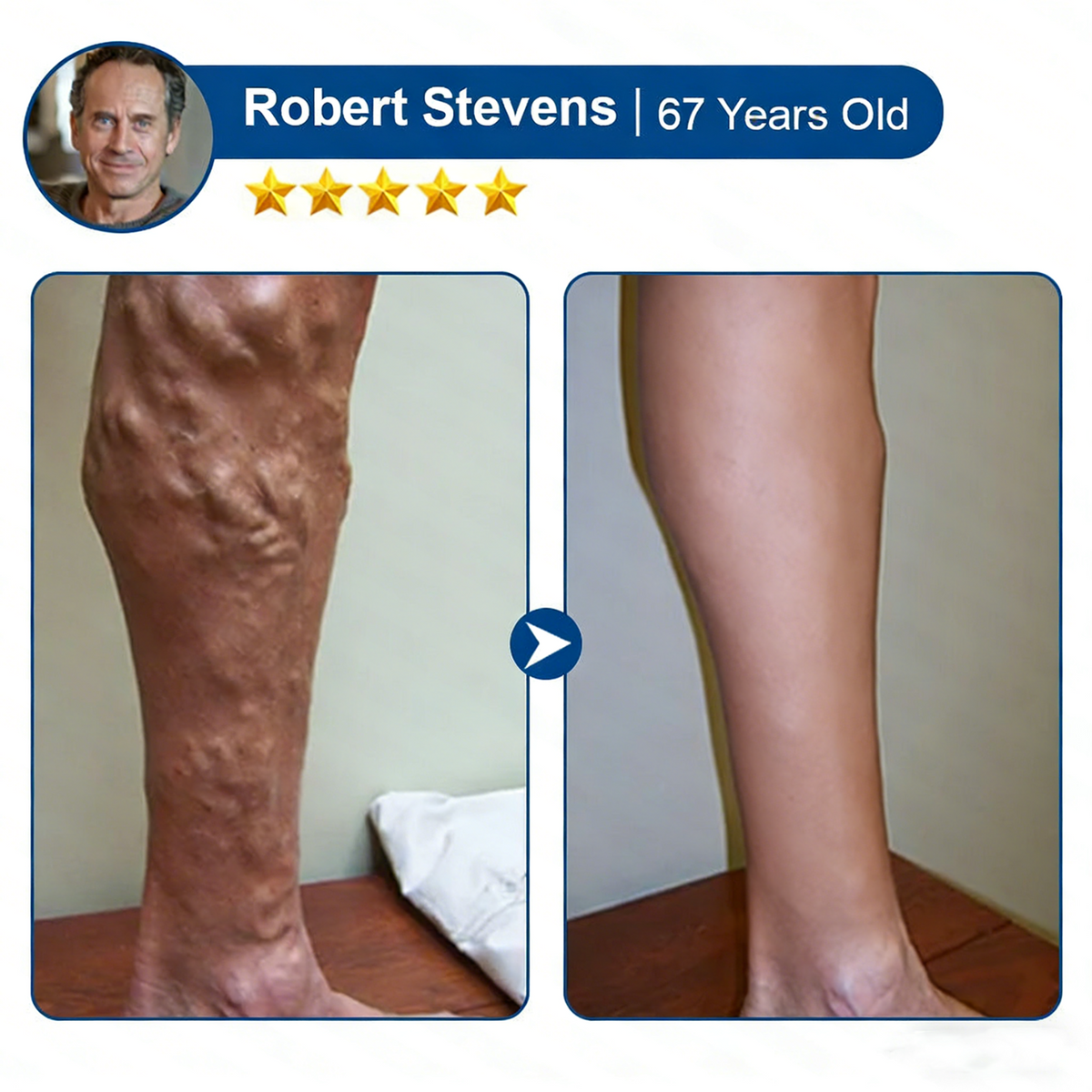 LegEase – Comfortable Vein Care Patch System – image 11