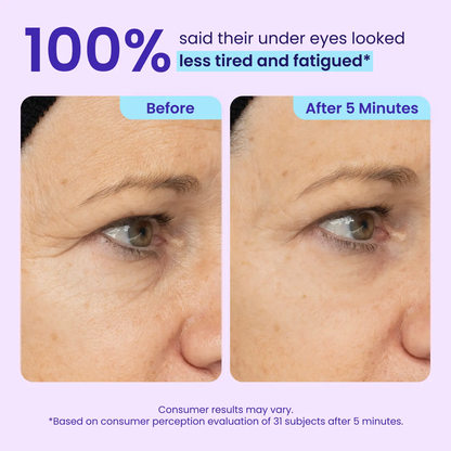 LumeGlow – Refreshing Rapid Reduction Eye Serum – image 7
