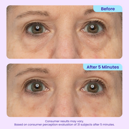 LumeGlow – Refreshing Rapid Reduction Eye Serum – image 5