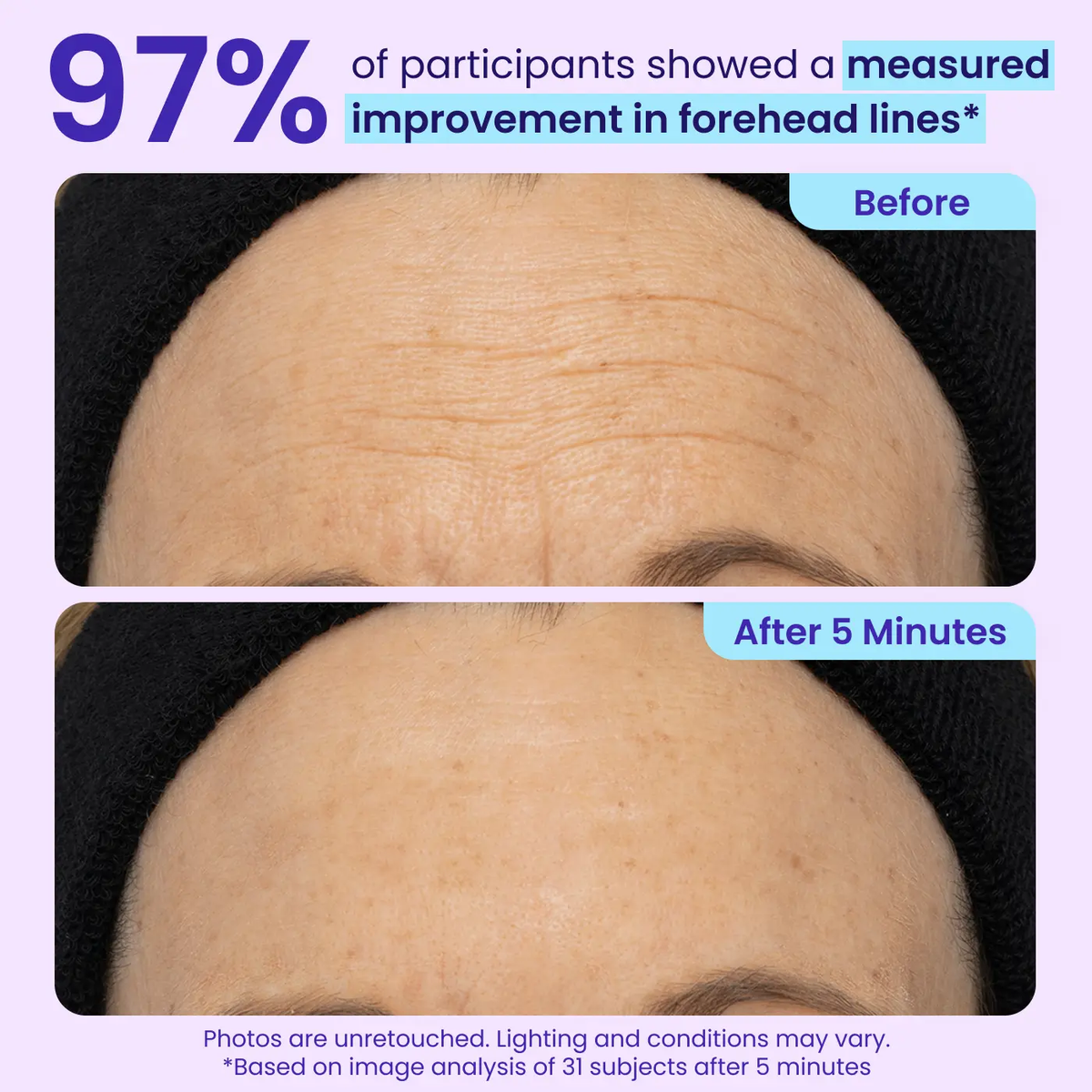 LumeGlow – Refreshing Rapid Reduction Eye Serum – image 6
