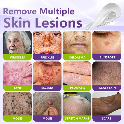 ClearDerma – Microneedle Skin Tag Removal Patch – image 3