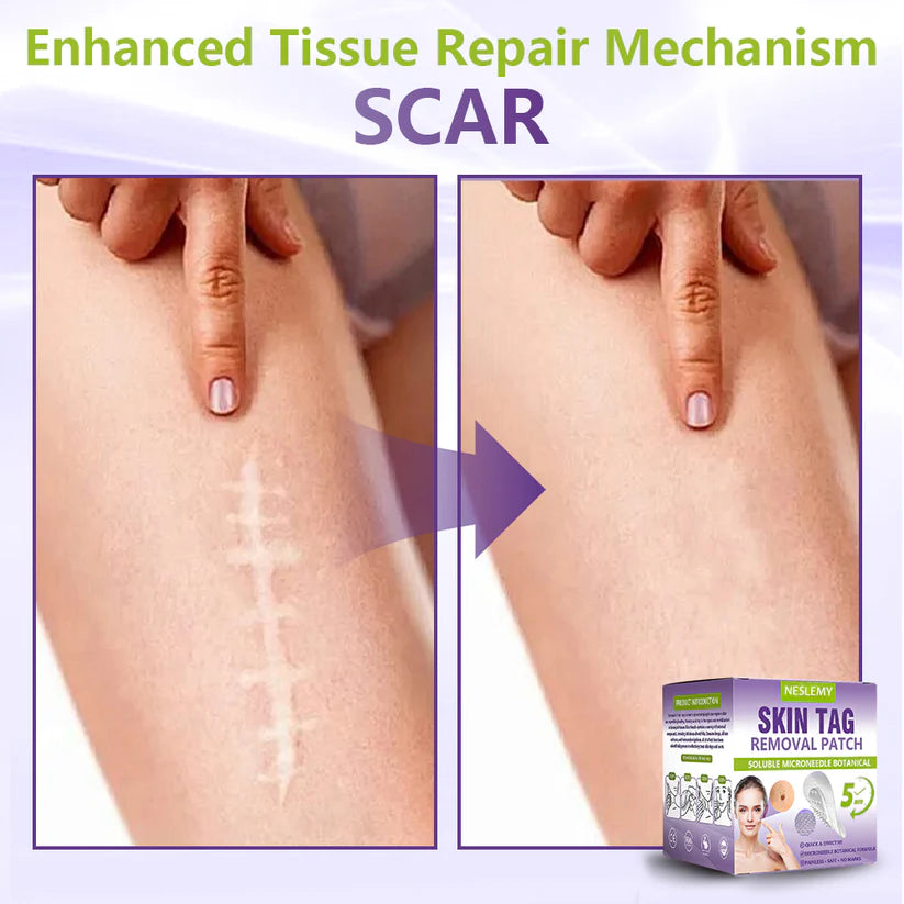 ClearDerma – Microneedle Skin Tag Removal Patch – image 13