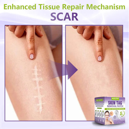 ClearDerma – Microneedle Skin Tag Removal Patch – image 13
