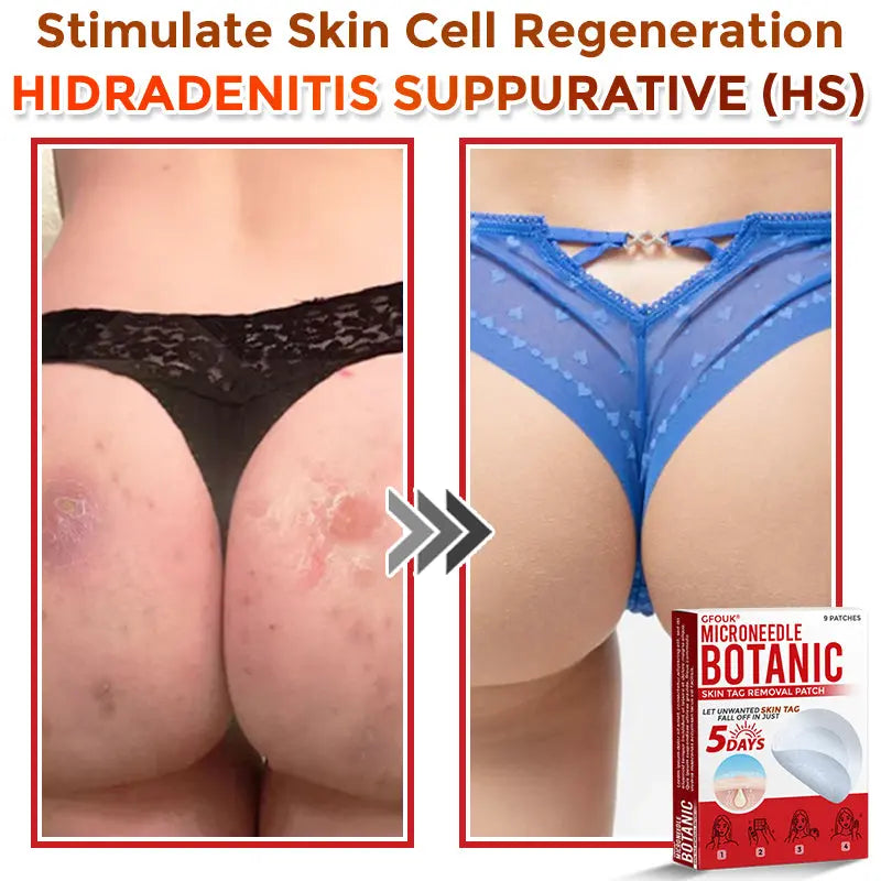 Natrvor –2-in-1 Microneedle Botanical Skin Renewal Patch – image 11