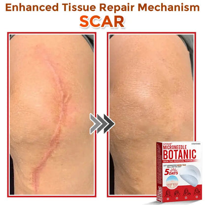 Natrvor –2-in-1 Microneedle Botanical Skin Renewal Patch – image 7