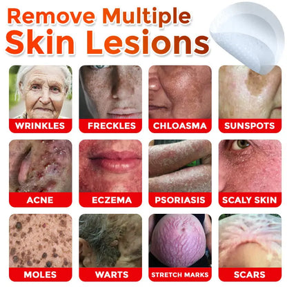 Natrvor –2-in-1 Microneedle Botanical Skin Renewal Patch – image 2