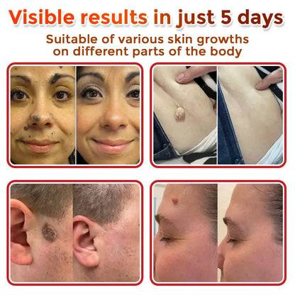 Natrvor –2-in-1 Microneedle Botanical Skin Renewal Patch – image 4