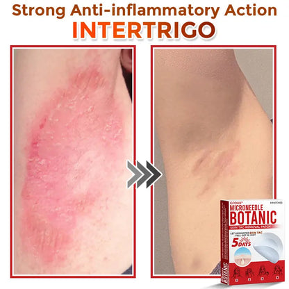 Natrvor –2-in-1 Microneedle Botanical Skin Renewal Patch – image 10