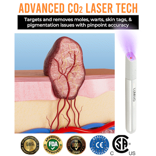 CleanBeam – Multi Function CO₂ Laser Eraser Pen Tool – image 6