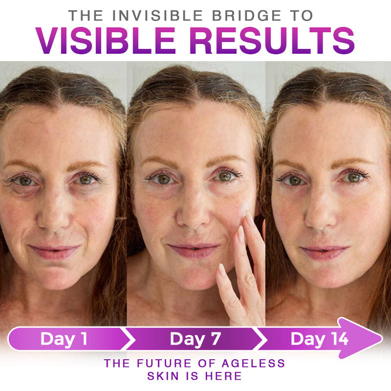 LumeDerm – Advanced Microneedle Patch – image 5