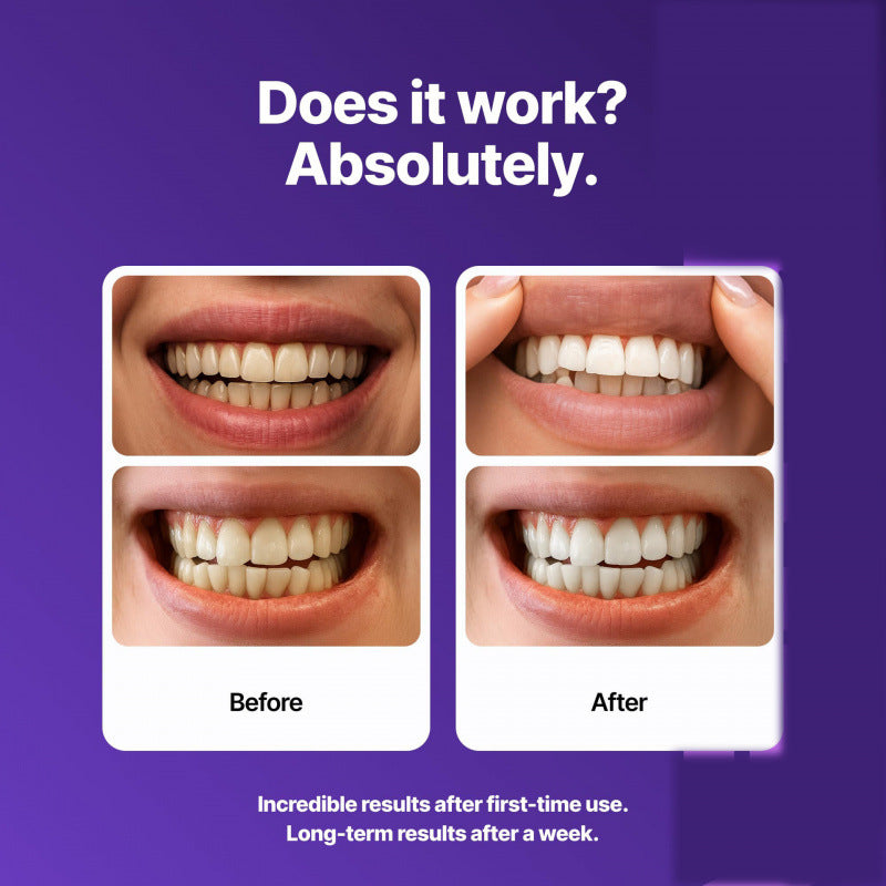 BrightViolet - Purple Teeth Whitening Strips – image 2