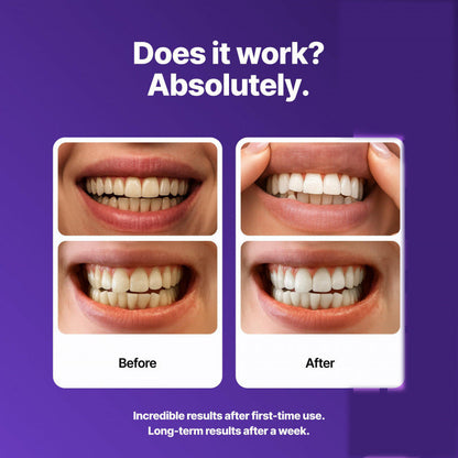 BrightViolet - Purple Teeth Whitening Strips – image 2