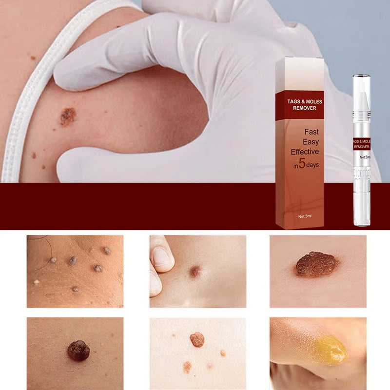 ClearGuard – Effective Wart Removal Pen – image 8