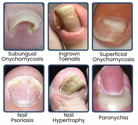 NailRevive Pro – Deep Care Patches – image 2