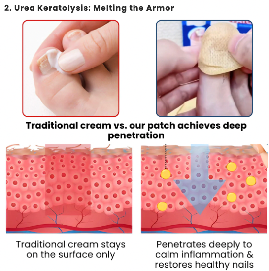 NailRevive Pro – Deep Care Patches – image 4