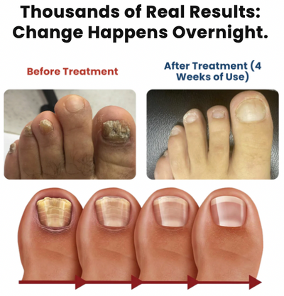 NailRevive Pro – Deep Care Patches – image 5