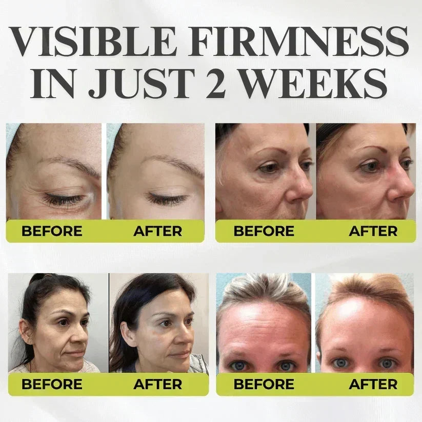 RevitaSkin – Wrinkle Lift Formula – image 5