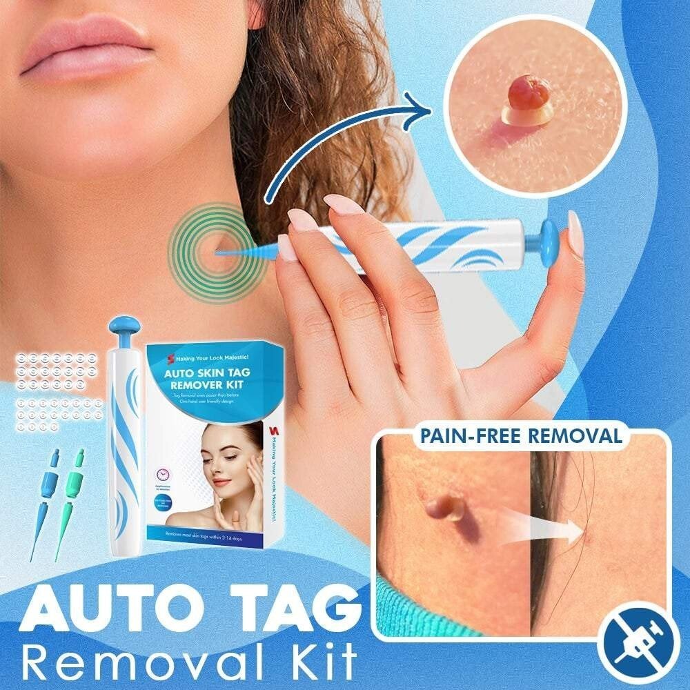 TagSnatch – Fast Auto Tag Removal Kit – Buy 1 Get 30% OFF