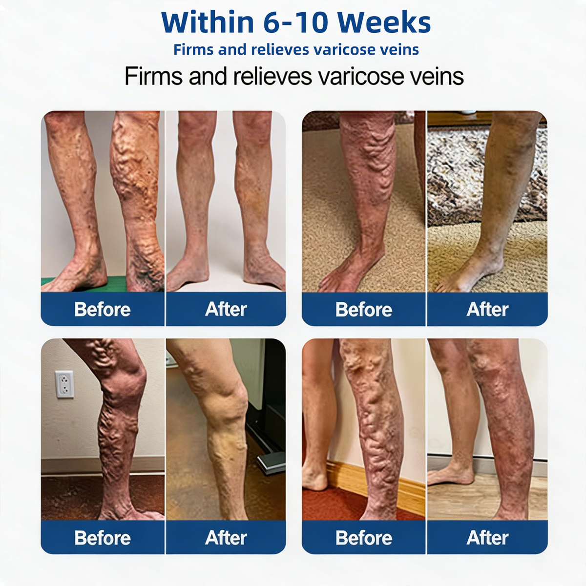 LegEase – Comfortable Vein Care Patch System – image 5
