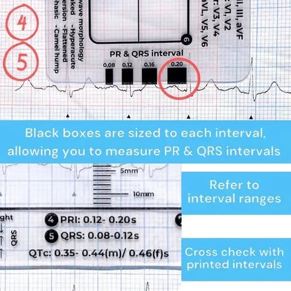 MediTrack – Professional ECG Assessment Pocket Guide – image 6