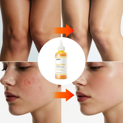 PureGlow – Kojic Acid Herbal Brightening Serum – image 5