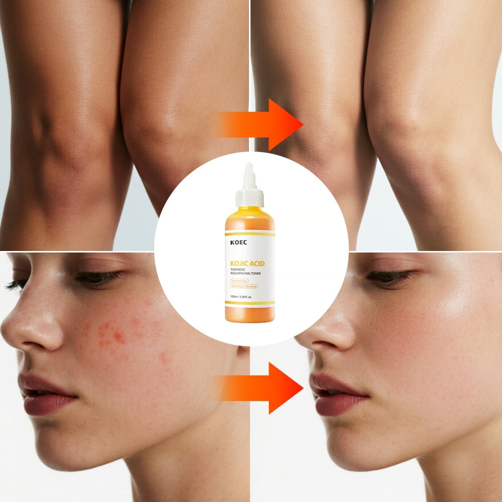 PureGlow – Kojic Acid Herbal Brightening Serum – image 2