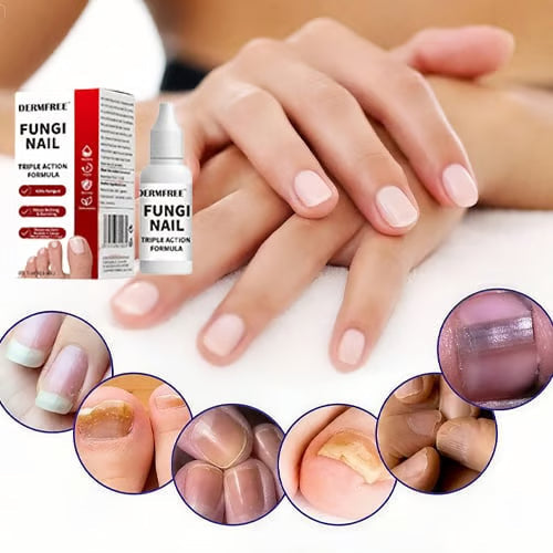 PureRoot – Extra Strength Toenail Treatment – image 4