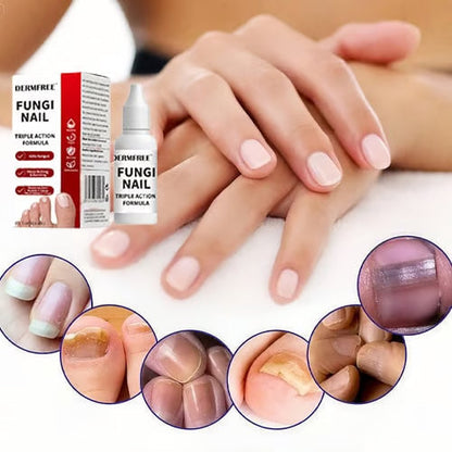 PureRoot – Extra Strength Toenail Treatment – image 4