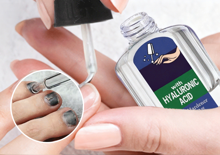 NailRevive Pro – Antifungal Repair Solution – image 4