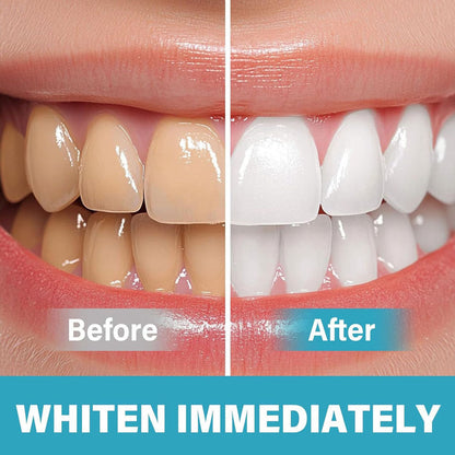 BrightSmile - Instant Teeth Whitening Pigment – image 7