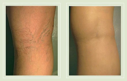 GlowLegs – Airbrushed Finish Leg Concealer – image 14