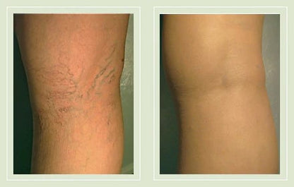 GlowLegs – Airbrushed Finish Leg Concealer – image 14