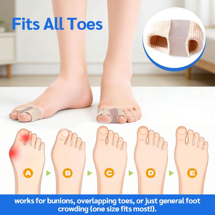 ToeAlign – Bunion Corrector System – image 9