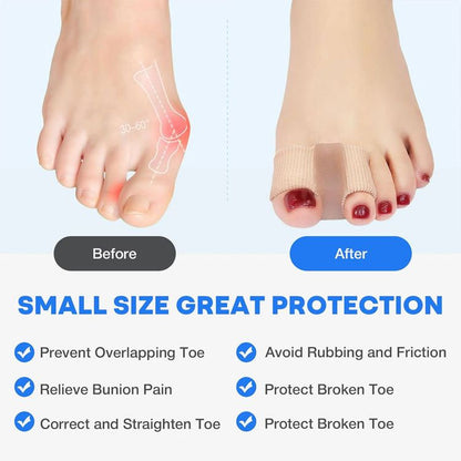 ToeAlign – Bunion Corrector System – image 4