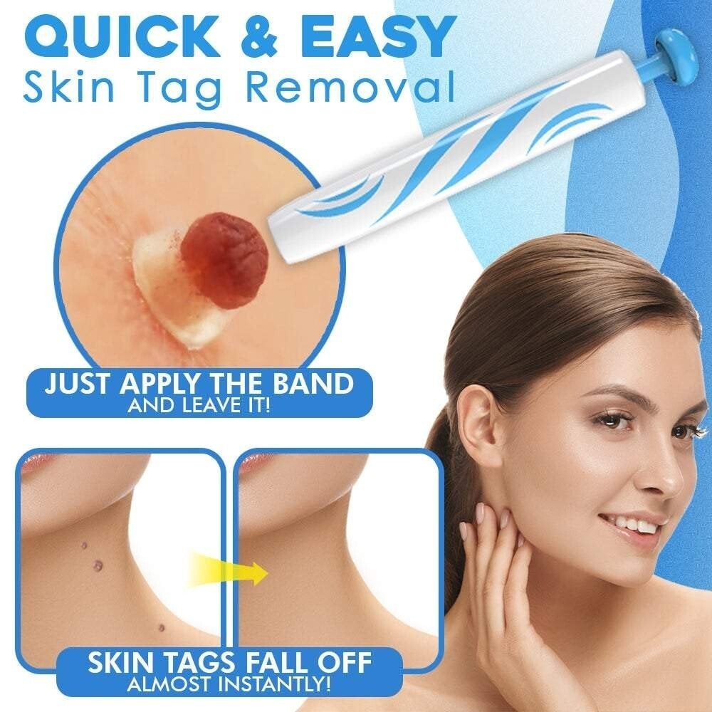 TagGone - Quick & Safe Skin Tag Remover – image 2
