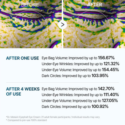 LumeLift – Rapid Eyebag Repair Cream – image 7